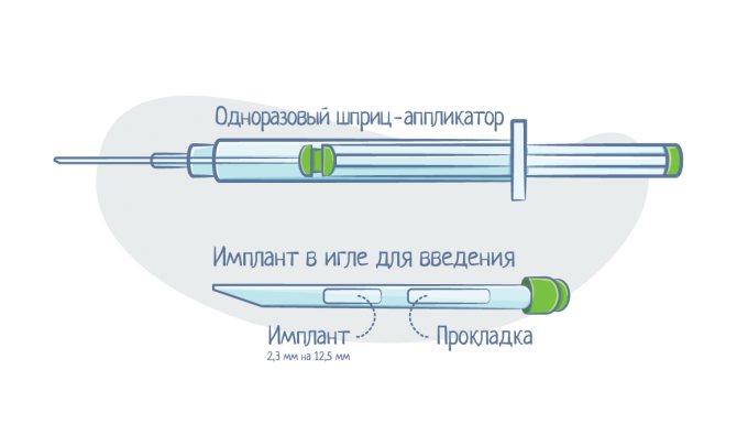 Размер противозачаточного импланта Супрелорин
