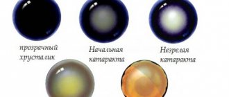 стадии течения катаракты у животного