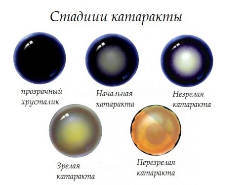 стадии течения катаракты у животного