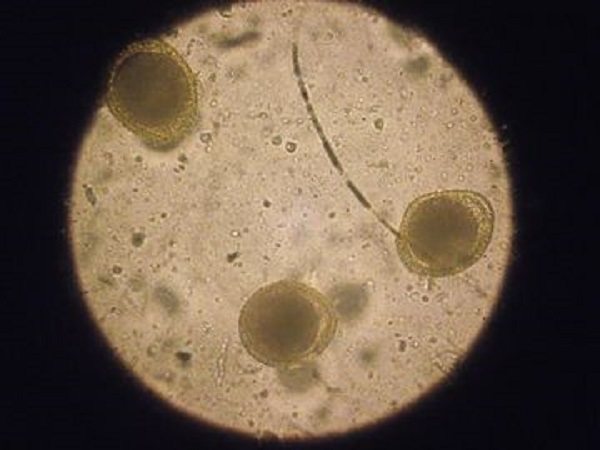 Яйца Toxocara cati