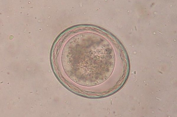 Яйца Toxocara leonina